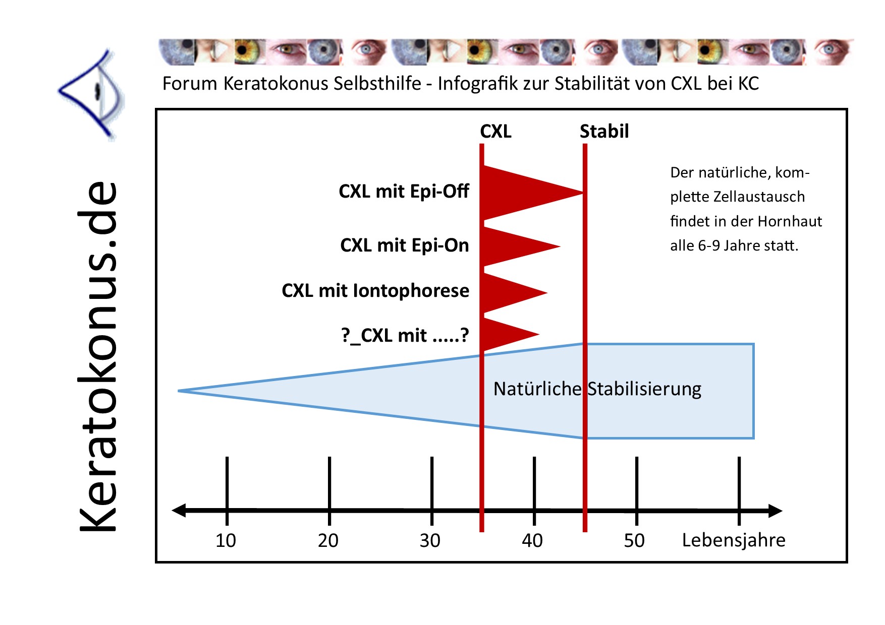 KC copyright by Keratokonus de how long lasts clx 001